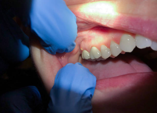Best Dentist for Severe Toothache  in Wellston, OH