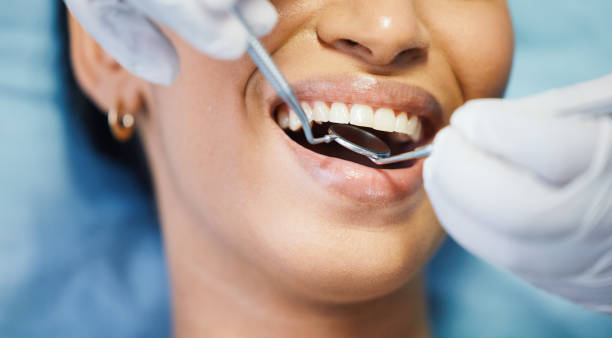 Best Same-Day Dentist Appointment  in Wellston, OH