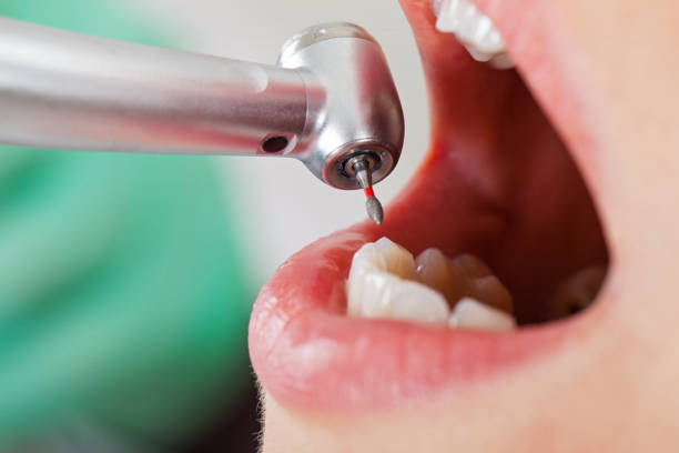 Urgent Tooth Repair in OH